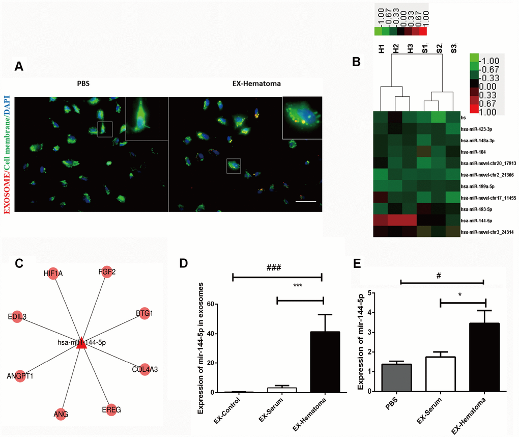 Hematoma-derived exosomes are enriched with miR-144-5p, which they can transfer to HUVECs. (A) PKH26-stained hematoma-derived exosomes (red) were internalized by HUVECs (green; scale bar: 50 μm). (B) Heat map showing hierarchical clustering of altered miRNAs. Values represent the log2 (fold change) in miRNA expression relative to the expression in serum-derived exosomes from healthy controls. (C) Network of miR-144-5p. (D) RT-PCR confirming expression of miR-144-5p in hematoma-derived exosomes. (E) Quantitative analysis of miR-144-5p in HUVECs following co-culture with exosomes. MiR-144-5p expression was higher in the EX-Hematoma compared to EX-Serum group. * p 