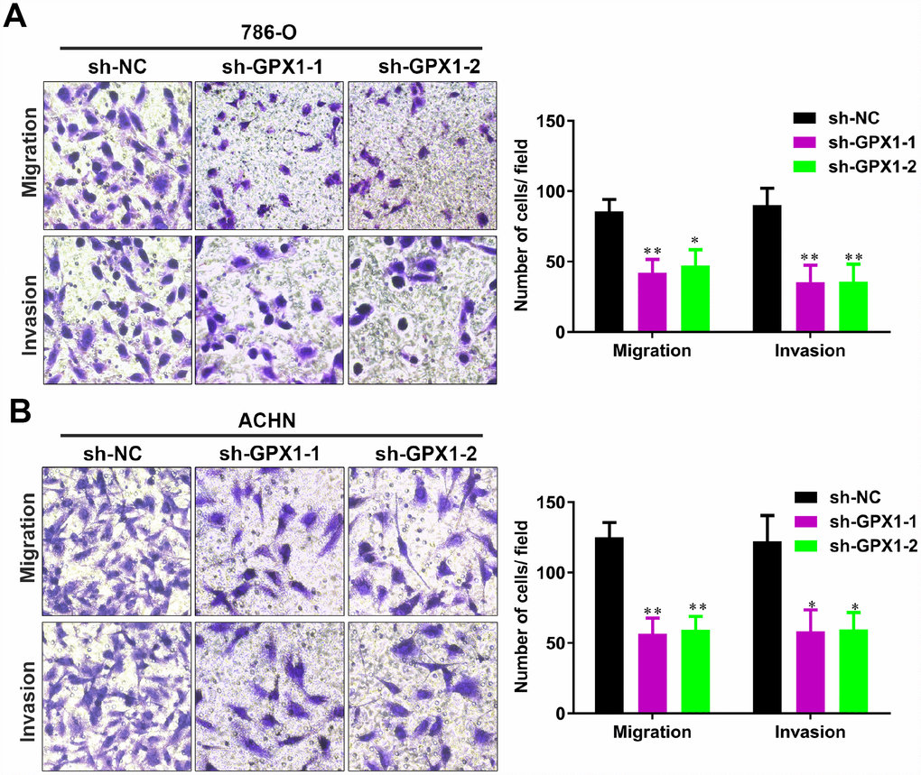 The knockdown of GPX1 levels significantly inhibits migration and invasion of renal cancer cells in vitro. (A, B) Transwell assays analysis of the impact of GPX1 levels knockdown on cell migration and invasion of 786-O and ACHN. (**, P 