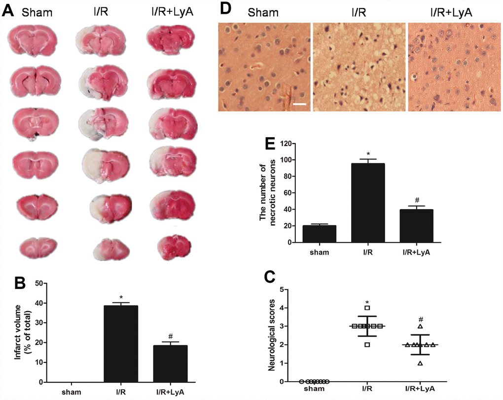 LyA protects against cerebral ischemic-reperfusion injury. (A) TTC staining of the cerebral infarct in the sham, control and treatment with LyA groups. (B) The columnar diagram for the infarct volume of brains in each group (n=6). (C) Neurological scores of rats at 48 h after cerebral I/R for each group (n=8). (D) H-E stains of coronal sections from the ischemic cerebral cortex (scale bar 100 μm). (E) Necrotic neurons were counted and analyzed in each group (n=6). All data, except for neurological scores, were expressed as mean ± SD. *p #p 