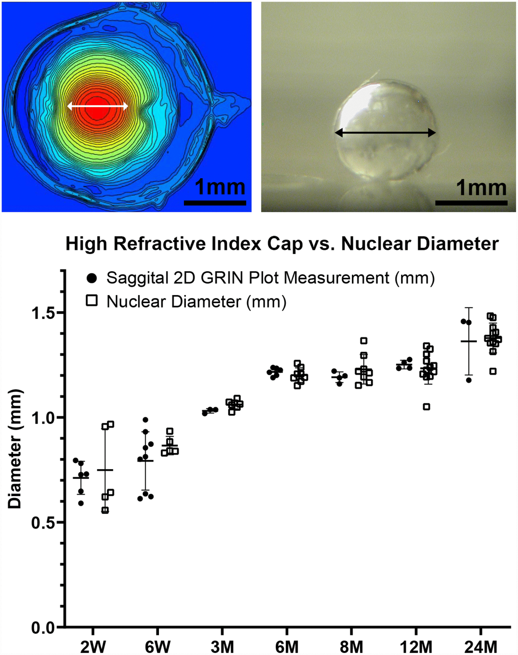 A comparison of the diameter of the cap region of high refractive index and the diameter of the extracted lens nucleus. The images show a representative mid-sagittal 2D contour plot and a representative lens nucleus with double-headed arrows indicating measured diameters. The graph compares the cap diameter in the sagittal 2D GRIN plot to the diameter of the lens nucleus. Lines on the plots reflect mean ± SD of n = at least 3 lenses from different mice per age. There was no statistically significant difference between the cap and nucleus diameters indicating that the area of high refractive index is directly correlated with the hard and compact lens nucleus. Scale bars, 1mm.