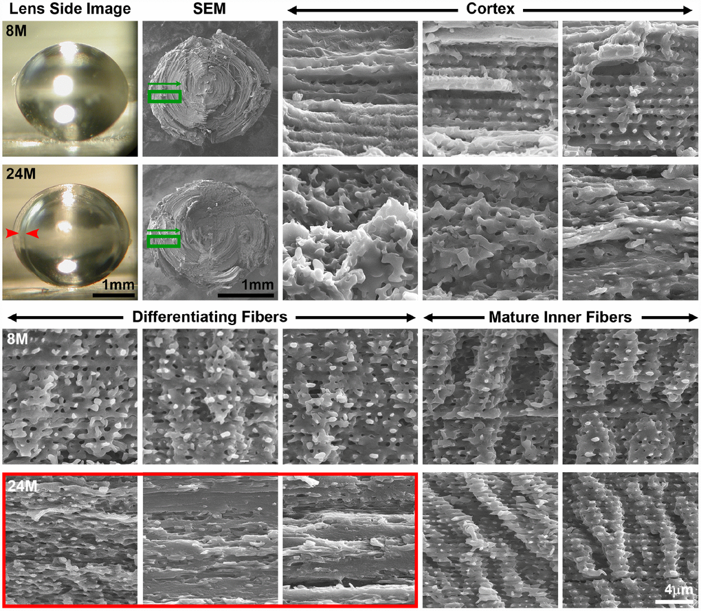 Side view lens images and scanning electron microscopy (SEM) at various depths in 8-month-old and 24-month-old lenses. Boxed regions in green on the low magnification SEM image indicate the approximate location where high magnification images were obtained. Cortical, newly formed fiber cells are disorganized in the 24-month-old lens compared to orderly cortical fibers in the 8-month-old lens. Differentiating fiber cells in deeper cortex layers (~100–200μm from the surface) of the 24-month-old lens lack normal small protrusions and formed a distinct zone of compaction. The location of the zone of compaction is correlated with the ring opacity (red arrows, red box). Mature inner fiber cells (~200-400μm from the surface) are comparable between the 8- and 24-month-old lenses with large paddles and small protrusions. Scale bars, 1mm (lens picture and low magnification SEM) and 4μm (high magnification SEM).