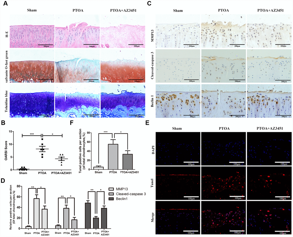 AZ3451 rescues cartilage destruction in rat OA model in vivo. (A) Representative H&E, Toluidine blue and Safranin O/Fast Green staining of cartilage in three groups after 8-week post-surgery. (B) OARIS scores of cartilage in three groups. (C, D) Immunohistochemical staining assay of MMP13, Cleaved-caspase3 and Beclin1 in the rat cartilage. (E, F) TUNEL staining assay in the rat cartilage. Data are shown as the mean ± SD. Significant differences between groups are indicated as ***P 