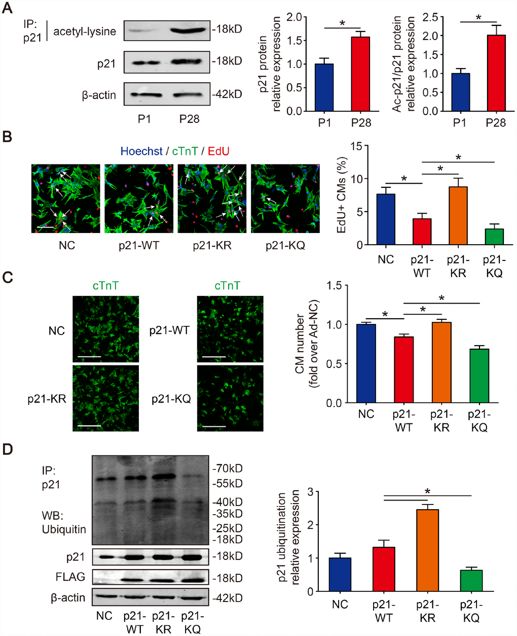 Deacetylation of p21 attenuates p21 stability and CM cell cycle arrest. (A) P1 and P28 mouse heart lysates were immunoprecipitated with a p21 antibody and analyzed by Western blotting with acetyl-lysine antibody; Western blotting was used to evaluate p21 protein expression in P1 and P28 mouse heart lysates. β-actin was used as a loading control (n=5). (B) Isolated P1 CMs were transfected with NC, p21-WT, p21-KR, or p21-KQ. EdU incorporation was detected by immunofluorescence. Scale bar, 50 μm. Quantitative analyses represent fields from 5 mice per group. (C) Isolated P1 CMs were transfected with NC, p21-WT, p21-KR, or p21-KQ and quantification of counts from P1 CMs transfected with NC, p21-WT, p21-KR, or p21-KQ (n=5). cTnT immunofluorescence was assessed to detect CM numbers. Scale bar, 500 μm. (D) Isolated P1 CMs were transfected with NC, FLAG-p21-WT, FLAG-p21-KR or FLAG-p21-KQ. Whole cell lysates were immunoprecipitated with a p21 antibody and analyzed by Western blotting with an ubiquitin antibodies; Western blotting was used to detect p21 levels. β-actin was used as a loading control (n=5). Statistical significance was calculated using a two-tailed unpaired Student’s t-test in (A) and a one-way ANOVA followed by an LSD post hoc test in (B–D). *p