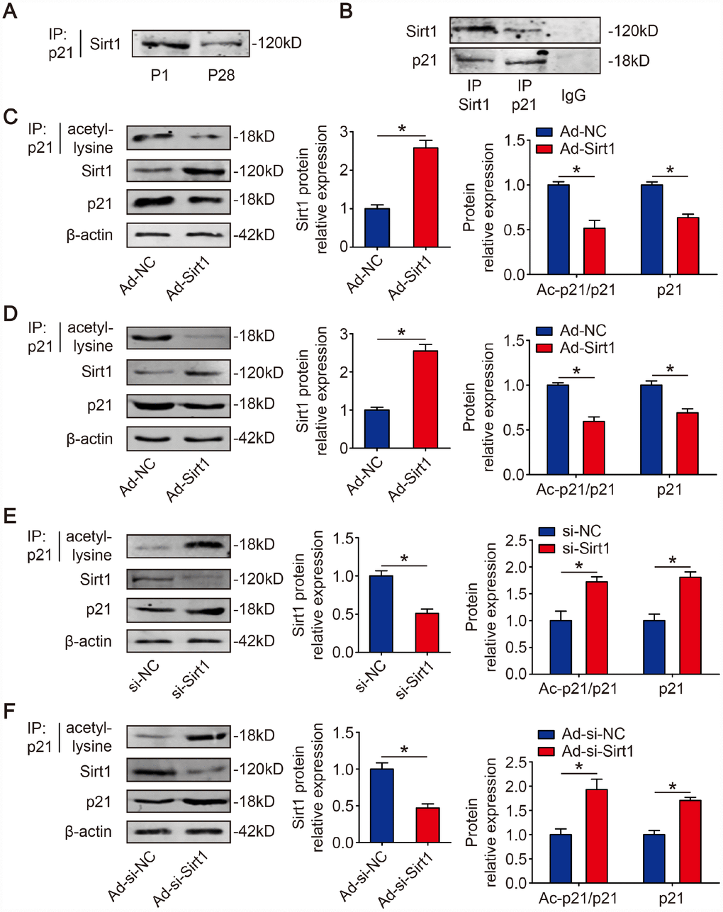 p21 is deacetylated by Sirt1 in CMs. (A) P1 and P28 mouse heart lysates were immunoprecipitated with a p21 antibody and analyzed by Western blotting with Sirt1 antibody (n=5). (B) Sirt1 was precipitated from isolated P1 CMs with Sirt1 antibody and blotted with p21 antibody, and vice versa (n=5). Negative controls: IgG. (C) Isolated P1 CMs were transfected with Ad-NC or Ad-Sirt1. Whole cell lysates were immunoprecipitated with a p21 antibody and analyzed by Western blotting using an acetyl-lysine antibody; Western blotting was performed to assess Sirt1 and p21 protein expression in Ad-NC or Ad-Sirt1 P1 CMs. β-actin was used as a loading control (n=5). (D) Adult mouse hearts were injected with Ad-NC or Ad-Sirt1. Heart lysates were immunoprecipitated with a p21 antibody and analyzed by Western blotting with an acetyl-lysine antibody; Western blotting was performed to evaluate Sirt1 and p21 protein expression in Ad-NC or Ad-Sirt1 adult heart lysates (n=5). (E) Isolated P1 CMs were transfected with si-NC or si-Sirt1. Whole cell lysates were immunoprecipitated with a p21 antibody and analyzed by Western blotting using an acetyl-lysine antibody; Western blotting was performed to evaluate Sirt1 and p21 protein expression in si-NC or si-Sirt1 P1 CMs (n=5). (F) P1 mouse hearts were injected with Ad-si-NC or Ad-si-Sirt1. Heart lysates were immunoprecipitated with a p21 antibody and analyzed by Western blotting using an acetyl-lysine antibody; Western blotting was performed to evaluate Sirt1 and p21 protein expression in Ad-si-NC or Ad-si-Sirt1 adult heart lysates (n=5). Statistical significance was calculated using a two-tailed unpaired Student’s t-test in C–F. *p