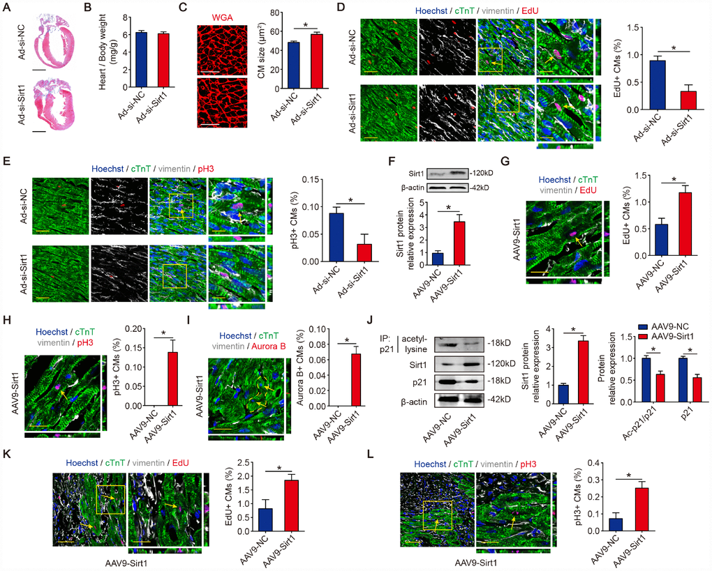 Sirt1 drives CM proliferation in vivo. (A) Masson staining of sagittal heart sections from neonatal mice injected with Ad-si-NC or Ad-si-Sirt1, Scale bar, 1mm. (B) Ratios of heart weight-to-body weight in neonatal mouse hearts injected with Ad-si-NC or Ad-si-Sirt1 (n=5). (C) WGA staining of sagittal heart sections in the Ad-si-NC and Ad-si-Sirt1 groups at P10. Quantitative analyses are representative of fields from 5 mice per group, Scale bar, 50μm. (D) Immunofluorescence for EdU and quantification of EdU-positive CMs in neonatal hearts injected with Ad-si-NC or Ad-si-Sirt1 (n=5). The arrows indicate EdU-positive CM nuclei. Scale bar, left, 50 μm, right, 20 μm. (E) Immunofluorescence for pH3 and quantification of pH3-positive CMs in neonatal hearts injected with Ad-si-NC or Ad-si-Sirt1 (n=5). The arrow indicates pH3-positive CM nuclei. Scale bar, left, 50 μm, right, 20 μm. (F) Western blotting analyses of Sirt1 levels in adeno-associated virus 9-negative control (AAV9-NC) or adeno-associated virus 9-Sirt1 (AAV9-Sirt1) injected adult mouse hearts 28 days after injection. β-actin was used as a loading control (n=5). (G) DNA synthesis was assessed using EdU immunofluorescence staining and EdU-positive CMs were quantified in AAV9-NC and AAV9-Sirt1 adult mouse hearts. The arrow indicates EdU-positive CM nuclei. Scale bar, 20μm. Quantitative analyses are representative of fields from 5 mice per group. (H) Mitosis was detected using pH3 immunofluorescence staining and pH3-positive CMs are quantified in AAV9-NC and AAV9-Sirt1 adult mouse hearts. The arrow indicates pH3-positive CM nuclei. Scale bar, 20μm. Quantitative analyses are representative of fields from 5 mice per group. (I) Cytokinesis was detected using Aurora B immunofluorescence staining and Aurora B-positive CMs were quantified in AAV9-NC and AAV9-Sirt1 adult mouse hearts. The dotted lines indicate the daughter cells and the arrows indicate their nuclei. Scale bar, 20μm. Quantitative analyses are representative of fields from 5 mice per group. (J) 8-week-old MI mouse hearts were injected with AAV9-NC or AAV9-Sirt1. Heart lysates were immunoprecipitated with a p21 antibody and analyzed by Western blotting using an acetyl-lysine antibody; Western blotting was performed to evaluate Sirt1 and p21 protein expression in AAV9-NC or AAV9-Sirt1 adult heart lysates (n=5). (K) DNA synthesis was assessed using EdU immunofluorescence staining and quantification of EdU-positive CMs in AAV9-NC and AAV9-Sirt1 adult mouse hearts 28 days after MI. The arrows indicate EdU-positive CM nuclei. Scale bar, 20μm. Quantitative analyses are representative of fields from 5 mice per group. (L) Mitosis was detected using pH3 immunofluorescence staining and pH3-positive CMs were quantified in AAV9-NC and AAV9-Sirt1 adult mouse hearts 28 days after MI. The arrows indicate pH3-positive CM nuclei. Scale bar, 20μm. Quantitative analyses are representative of multiple fields from 5 mice per group. Statistical significance was calculated using a two-tailed unpaired Student’s t-test in A-L. *p