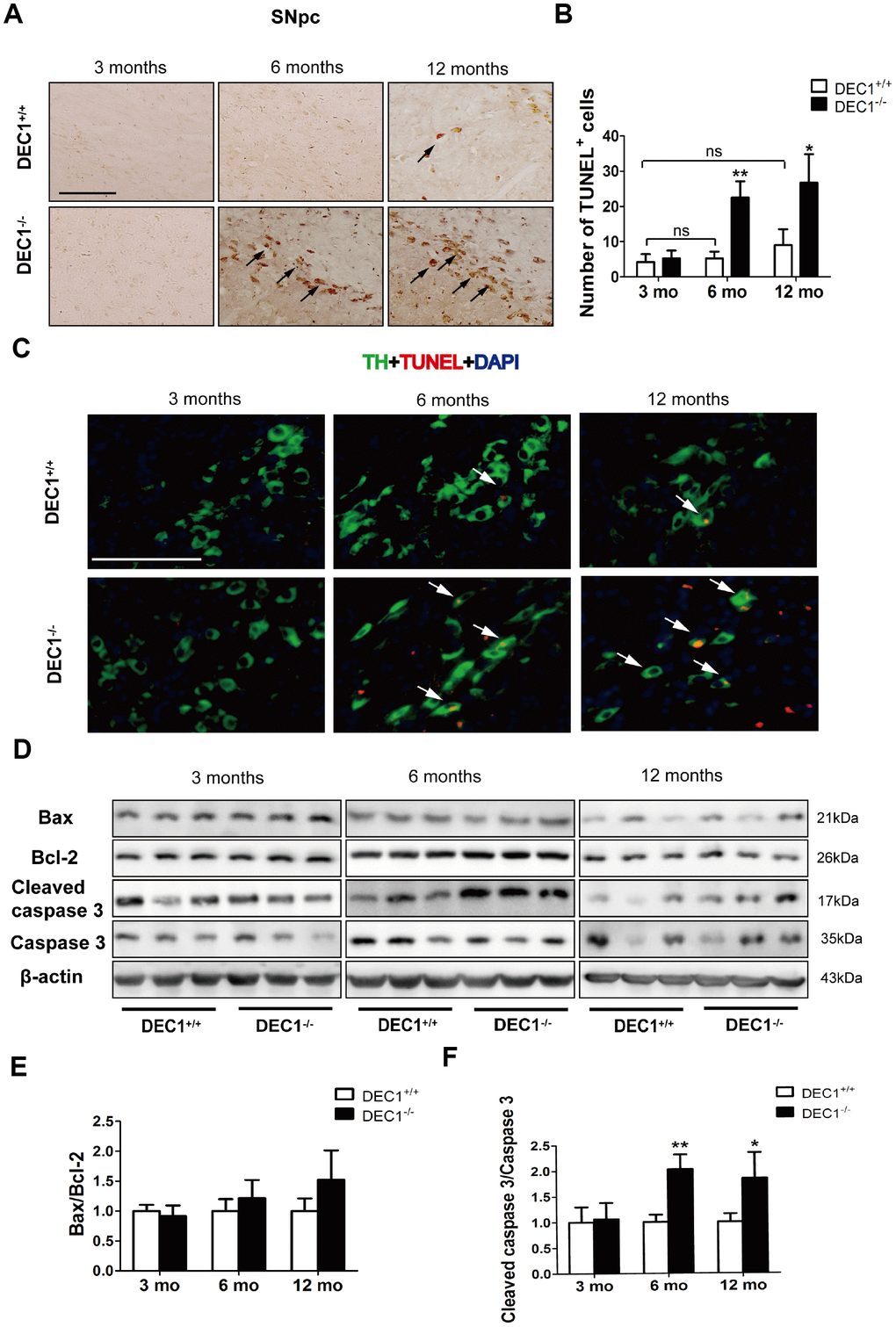 DEC1 deficient mice show an increase in neuron apoptosis in the SNpc. (A) Representative images of TUNEL+ cells in the SNpc of DEC1+/+ and DEC1-/- mice at 3, 6 and 12 months(n=4 in each group). TUNEL+ apoptotic cells were labeled by black arrowheads. (B) The number of TUNEL+ cells (Two-way AONVA, gene: F(1,18)=42.961, p2,18)=18.002, p2,18)=9.031, p=0.002). (C) Representative images of TH (red), TUNEL (green) and DAPI(blue) in the SNpc of DEC1+/+ and DEC1-/- mice at the age of 3, 6 and 12 months(n=4 in each group). TUNEL+ apoptotic cells co-expressed with TH+ cells were labeled by white arrowheads. (D) The expression of the apoptosis-related proteins at the age of 3, 6 and 12 months (n=6 in each group). (E) Bax/Bcl-2 (Two-way AONVA, gene: F(1,18)=4.743, p=0.069; age: F(2,18)=2.419, p=0.117; interaction: F(2,18)=2.419, p=0.117). (F) The cleaved caspase 3/caspase 3 (Two-way AONVA, gene: F(1,18)=25.945, p(2,18)=5.518, p=0.014; interaction: F(2,18)=5.518, p=0.014). The data are analyzed using t-test for the same age in two genotypes of mice and expressed as mean ± SD. *p+/+ mice. ns p>0.05, comparisons are shown in the figure. Scale bar=100 μm.