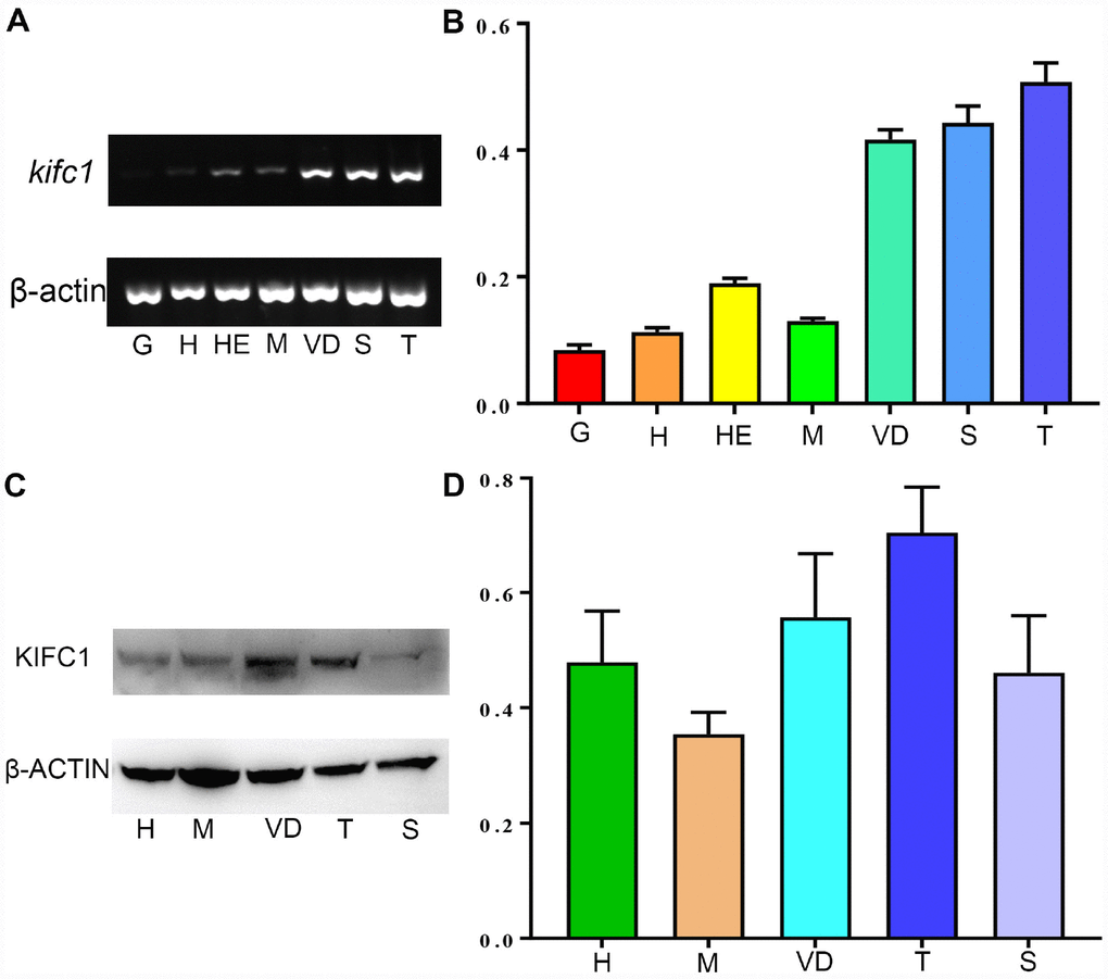 The expression of KIFC1 in different tissues. (A) kifc1 mRNA expression in various P. japonicus tissues was shown by semi-quantitative RT-PCR analysis in the upper panel. The lower panel, β-actin, was used as a positive control. (B) A quantitative analysis of kifc1 mRNA expression in various P. japonicus tissues was shown by Image J. The highest expression of kifc1 appears in the testis. (C) The expression of KIFC1 protein in various P. japonicus tissues was shown in the upper panel by western blot. The lower panel, β-actin, was used as a positive control. (D) A quantitative analysis of KIFC1 expression in various P. japonicus tissues was shown by Image J. G: gill, H: heart, HE: hepatopancreas, M: muscle, S: spermatophore, T: testis, VD: vas deferens.