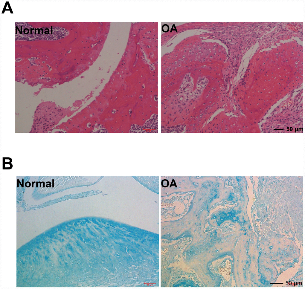Hmatoxylin and eosin (H&E), and acin blue staining. (A) Representative photomicrographs HE staining of joint pathological sections of normal mouse joints and OA model mice, twelve weeks after ACLT (n=4). (B) Alcian blue staining of normal mouse joints and surgically prepared OA model mouse joint pathological sections (n=4).