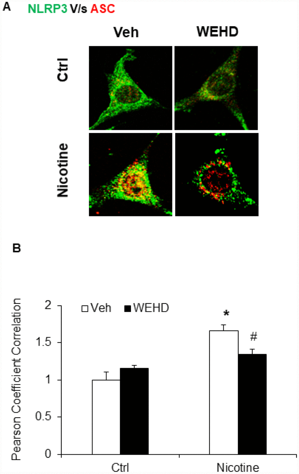 Nicotine induced NLRP3 inflammasome formation in podocytes. (A) Representative confocal fluorescence images show the colocalization of NLRP3 with ASC. (B) Summarized data shows the fold changes of pearson coefficient correlation (PCC) for the colo-calization of NLRP3 with ASC with or without stimulation of nicotine and/or caspase-1 inhibition by WEHD. N=5. Veh: Vehicle. *significant difference from control, # significant difference from nicotine treated group.