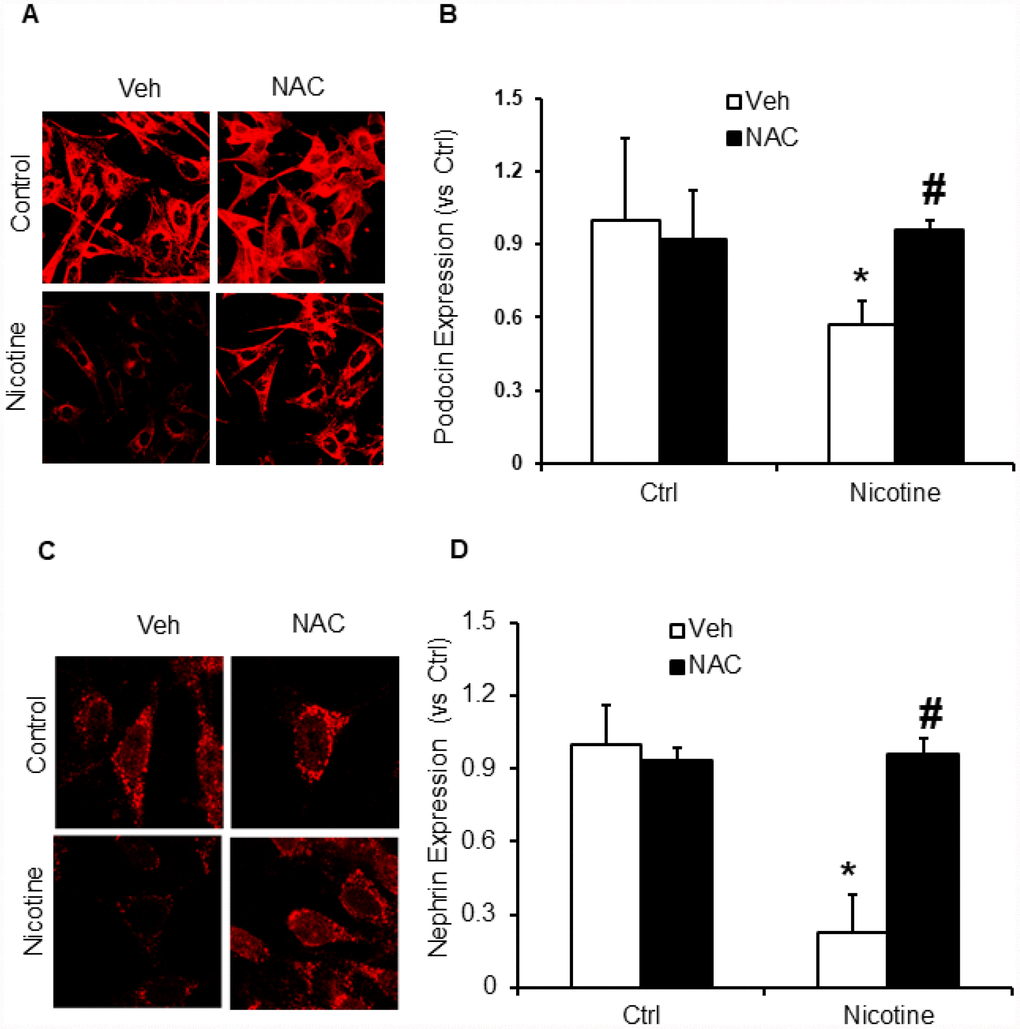ROS scavenger N-acetyl-cysteine (NAC) protected podocyte from nicotine-induced podocyte injury. Representative immunofluorescence images and summarized quantification data (n=6 each group) shows podocin (A) and nephrin (B) expression in podocytes treated with or without stimulation of nicotine and/or NAC. Images were quantified using Image J software. *significant difference from control, #significant difference from nicotine treated group.