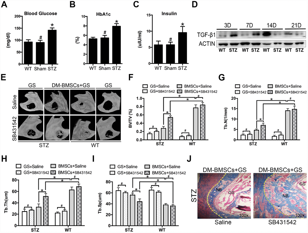 Suppression of TGF-β1 signaling promotes repair of mandible defects in diabetic rat. Blood was collected from the tail veins after overnight fasting, and blood glucose levels were measured using a glucometer (A). Blood samples were taken from anesthetized rats through retrobulbar venous plexuses. Serum insulin and HBA1c levels were measured in a clinical laboratory (B, C). Full thickness bone defect (1×3mm) was made in the mandibular margins, and calluses were harvested at postoperative 3, 7, 14, and 21 days. The expression of TGF-β1 was measured by western blot (D). Mandibular critical-sized bone defects (diameter 5mm) were made in an STZ-induced diabetic rat and WT rat model, and human DM-BMSCs with gelatin sponge (GS) or GS alone were implanted into defects. SB431542 or saline were injected into the local defect once every 2 days for 1 week. After 8 weeks, micro-CT images were taken (E). Trabecular bone volume fraction (BV/TV), trabecular number (Tb.N.), trabecular thickness (Tb.Th.), trabecular separation (Tb.Sp.) were analyzed (F–I). New bone formation in STZ group implantation of DM-BMSCs with GS were evaluated by Masson trichrome staining (J). Black dotted lines in E indicate the size and location of defect. Yellow dotted lines in J indicate the bonder of defect. NB, new bone, GS, gelation sponge. Data are presented as the mean ± standard deviation, n=3. *p#p>0.05.