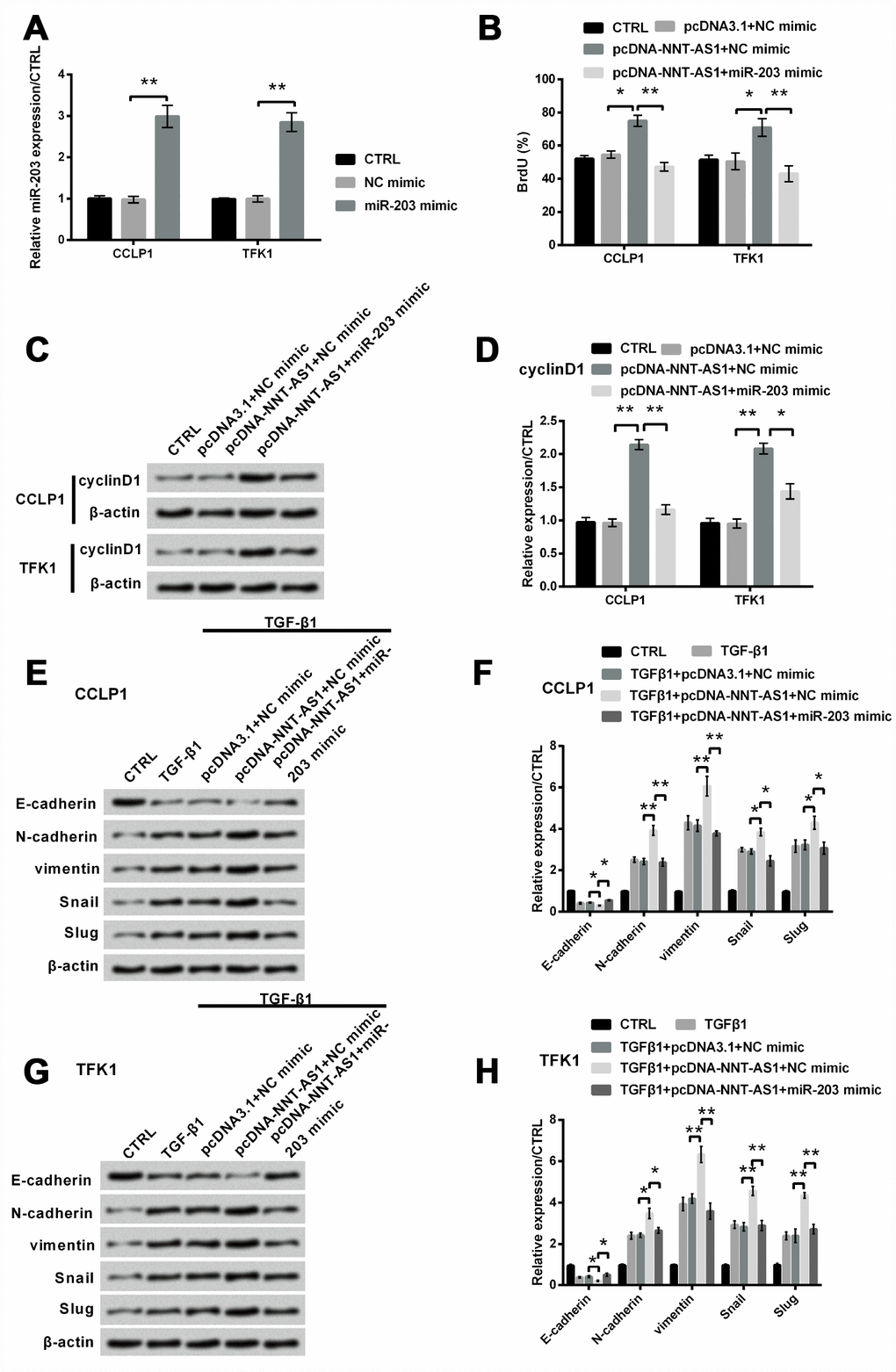 Mechanism of NNT-AS1 on proliferation and EMT in CCLP1 and TFK1 cells after co-transfection with pcDNA-NNT-AS1 and miR-203 mimic. (A) Standard of miR-203 was examined via qRT-PCR by transfection with miR-203 mimic. (B) Proliferation was examined via BrdU. Expression of cyclinD1 was examined via western blot (C) and analyzed quantitatively (D) in both cells. Expression of EMT related factors was inspected via western blot (E, G) and analyzed quantitatively (F, H) in CCLP1 and TFK1 cells. * P P 