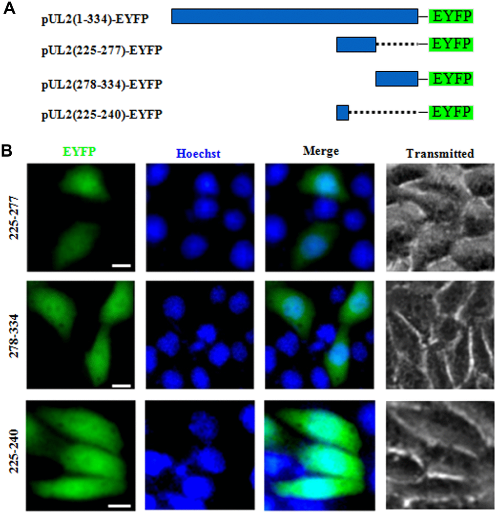 Determination the presμmed NES function of UL2. (A) Schematic representation of WT UL2 and its deletion mutants UL2(225-277), UL2(278-334) and UL2(225-240) fused with EYFP. (B) Subcellular localization of these UL2 deletion mutants (shown in A) in plasmid-transfected live COS-7 cells. All scale bars indicate 10 μm.