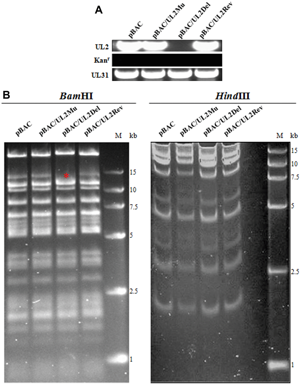 BACs construction of UL2-related recombinant HSV-1. (A) PCR analysis of the constructed recombinant BACs. The UL2, UL31 and Kanr genes were amplified from WT pBAC (lane 1), pBAC/UL2Mu (lane 2), pBAC/UL2Del (lane 3) and pBAC/UL2Rev (lane 4), respectively. (B) Gel electrophoresis (0.8%) of WT pBAC (lane 1) and recombinant BACs pBAC/UL2Mu (lane 2), pBAC/UL2Del (lane 3) and pBAC/UL2Rev (lane 4) analyzed by BamHI and HindIII restriction digestion, respectively. The red asterisk indicates the specific band that was disappeared only in pBAC/UL2Del genome when all the BACs were treated with BamHI digestion. Marker sizes in kb are indicated on the right side of the gels.