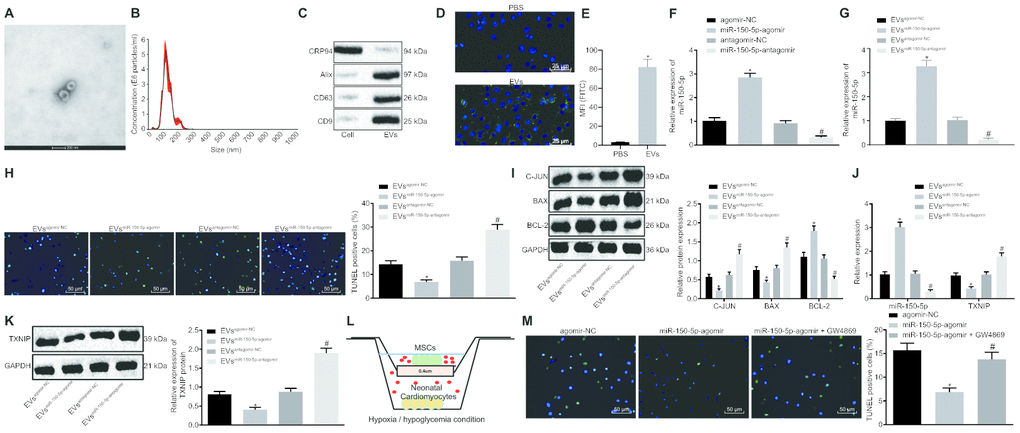 Cardiomyocyte apoptosis is suppressed by MSCs-derived EVs carrying miR-150-5p. (A) The images captured under transmission electron microscopy. (B) EV size measured by nanoparticle tracking analysis. (C) The expression of EV markers (CD9, CD63, Alix and GRP94) detected by Western blot analysis. (D) EV internalization detected by immunohistochemistry (400 ×). (E) PKH67-staining (FITC wavelength) in neonatal cardiomyocytes detected by flow cytometric analysis. (F) The expression of miR-150-5p in MSCs determined by RT-qPCR. (G) The expression of miR-150-5p in EVs determined by RT-qPCR. (H) neonatal cardiomyocyte apoptosis detected by TUNEL staining (200 ×). (I) The protein expression of apoptosis-related factors (c-Jun, Bax and Bcl-2) normalized to GAPDH determined by Western blot analysis. (J) The expression of miR-150-5p and TXNIP in neonatal cardiomyocytes determined by RT-qPCR. (K) TXNIP expression in neonatal cardiomyocytes normalized to GAPDH determined by Western blot analysis. (L) Transwell co-culture system under hypoxia/hypoglycemia condition. (M) Neonatal cardiomyocyte apoptosis detected by TUNEL staining (200 ×); * p vs. the agomir-NC group (cells treated with agomir-NC); # p vs. the miR-150-5p-agomir group (cells treated with miR-150-5p-agomir). * p vs. the agomir-NC group (cells treated with agomir-NC) or the EVagomir-NC group (cells treated with EVagomir-NC); # p vs. the antagomir-NC group (cells treated with antagomir-NC) or the EVantagomir-NC group (cells treated with EVantagomir-NC). Measurement data were presented as mean ± standard deviation. Comparison among multiple groups was analyzed by one-way analysis of variance, followed by Tukey’s post hoc test. The cell experiment was repeated 3 times independently.