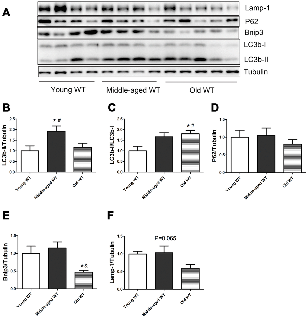 Expression of LC3b-II, LC3b-I, P62, Bnip3, and Lamp-1 proteins in young WT, middle-aged WT, and old WT mice. (A) Western blot images. (B–F) Statistical graphs. Data represent mean ± SE, (n=4-5). *P 