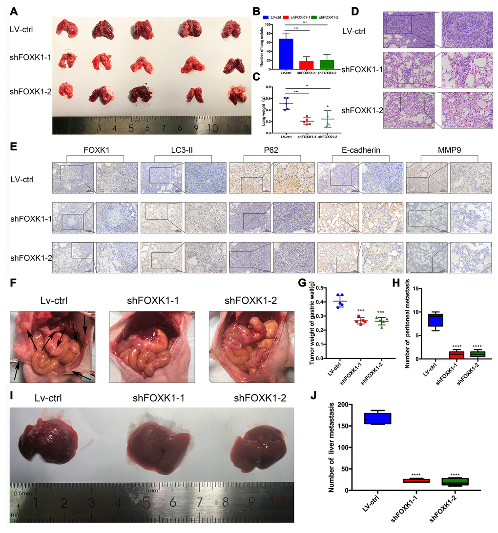Downregulation of FOXK1 inhibits metastasis in vivo. (A) Lung tissues were obtained from nude mice injected with differently treated MGC803 cells (n=5). (B) The number of lung nodules per nude mouse was determined. (C) The lung weight of each nude mouse was calculated. (D, E) Representative images of H&E staining of lung sections (scale bar, 100 μm and 50 μm) and IHC staining of FOXK1, LC3-II, P62, E-cadherin and MMP9 levels in lung tissue (scale bar, 100 μm and 50 μm). (F) MGC803 cells transfected with LV-shFOXK1-1 and LV-shFOXK1-2 were orthotopically transplanted into the stomach walls of nude mice (n=5). (G, H) Weight of gastric wall tumors (g) and number of metastatic tumors (H) at 28 days post transplantation with MGC803 cells. (I, J) Representative images (I) and number (J) of diffuse liver metastases. * P 