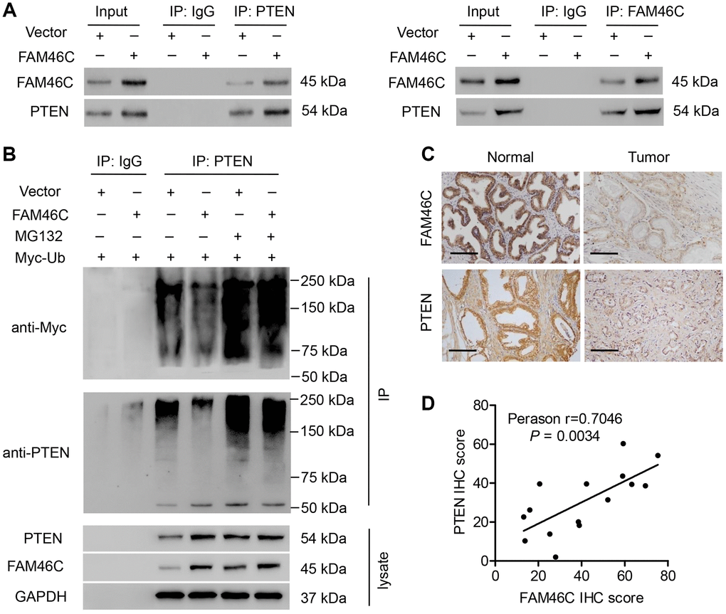 The correlation between FAM46C and PTEN. (A) Co-IP showed that FAM46C interacted with PTEN in DU145 cells. (B) PTEN was immunoprecipitated and immunoblotted in DU145 cells with 10 μM MG132 treatment and pLVX-Puro-FAM46C or blank pLVX-Puro transduction. (C) PTEN protein expression in prostate cancer tissues and noncancerous prostate tissues from hospital cohort were measured by immunohistochemistry. Scale bars: 100 μm. (D) Linear regression showed that FAM46C protein expression was positively correlated with that of PTEN (n=15).