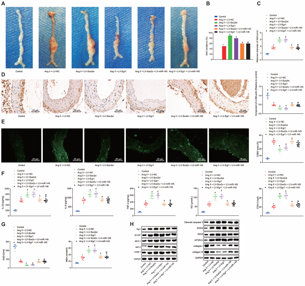 Silencing of lncRNA Sox2ot affecting miR-145 inhibits oxidative stress and inflammation in Ang II-induced AAA mice by downregulating Egr1. (A) representative morphology images of abdominal aorta specimens from mice; (B) incidence of inducing AAA mice; (C) the maximum diameter of abdominal aorta from mice; (D) α-SM-actin expression in SMCs in abdominal aorta determined using immunohistochemistry (× 400); (E) CD68 expression in abdominal aorta detected using immunofluorescence staining (× 400); (F) levels of inflammatory factors and oxidative stress-related factors measured in serum of mice measured using ELISA; (G) SOD level in serum and MDA levels in abdominal aorta of mice; (H) protein levels of Egr1, M-CSF, MCP-1, MIP-2, ICAM-1, cleaved caspase-3, iNOS, p47phox, collagen I and collagen III determined using Western blot analysis; * p vs. normal mice; # p vs. AAA mice injected with LV-NC; & p vs. AAA mice injected with LV-Sox2ot; @ vs. AAA mice, injected with LV-Egr1; measurement data were depicted as the mean ± standard deviation; comparisons among multiple groups were analyzed using one-way ANOVA followed by Turkey’s post hoc test; n = 10.