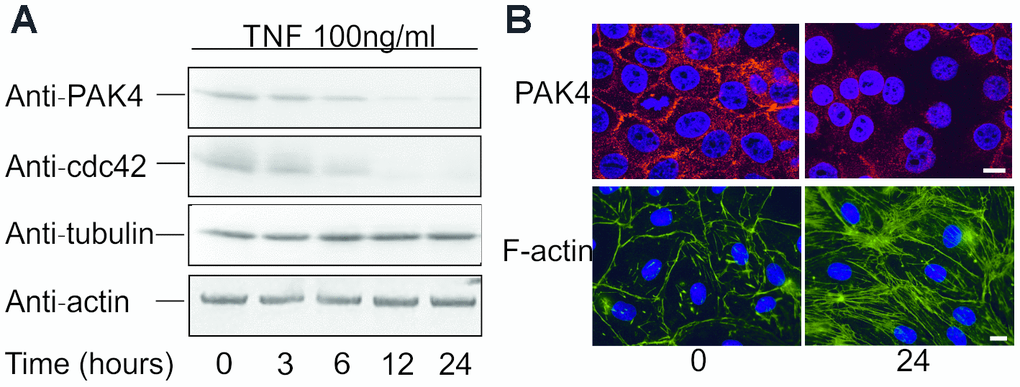 TNF down-regulates PAK4 and cdc42 expression in HUVECs. (A) Western blotting of HUVECs incubated with 100 ng/ml TNF for up to 24 hours, analyzed using anti-PAK4, anti-cdc42, anti-β-actin, and control anti-tubulin antibodies. (B) Confocal microscopy of HUVECs incubated 0 and 24 h with 100 ng/ml TNF, and stained for PAK4 and F-actin; scale bar = 10 μm. Cells were counter stained with DAPI.