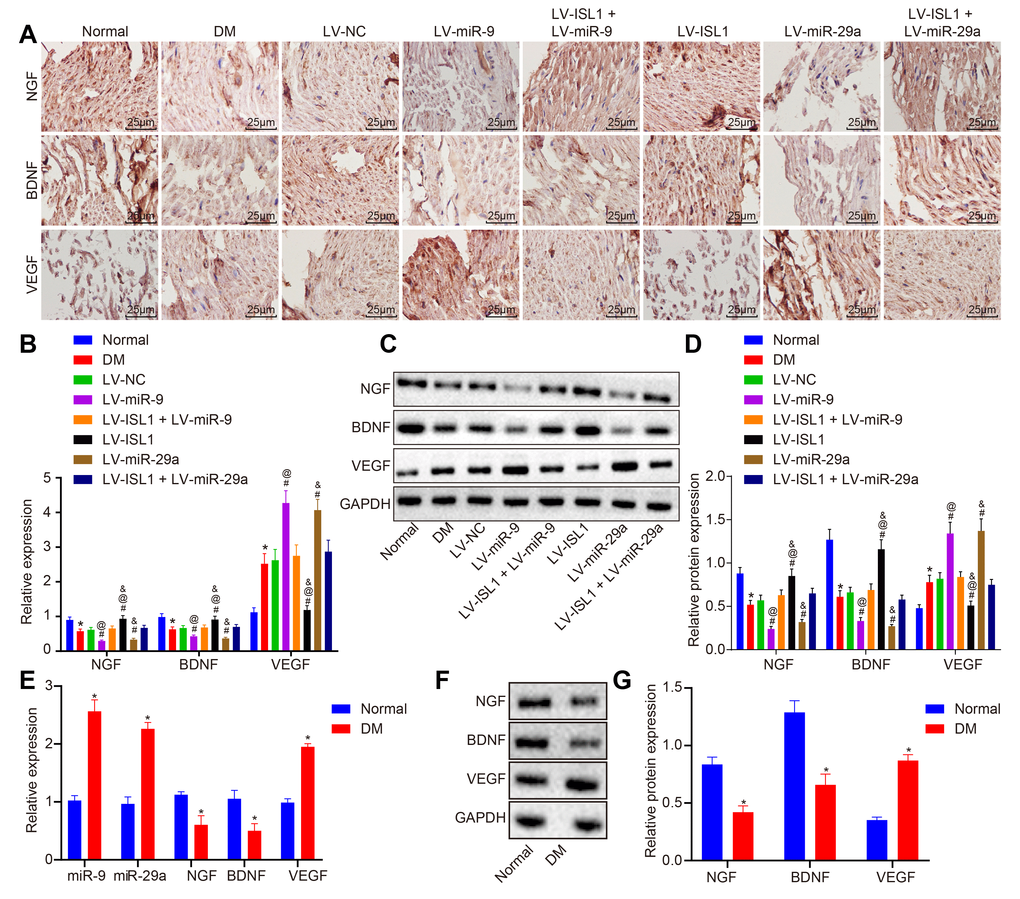 miR-9 and miR-29a affect neural regeneration after repair of sciatic nerve defect in rats and patients with DM. (A) The positive expression of NGF, BDNF and VEGF in sciatic nerve tissues of normal rats and rats with DM following lentiviral infection detected by immunohistochemistry (× 400) (n = 8). (B) mRNA expression of NGF, BDNF and VEGF in sciatic nerve tissues of normal rats and rats with DM following lentiviral infection detected by RT-qPCR (n = 8). (C, D) The protein expression of NGF, BDNF and VEGF in sciatic nerve tissues of normal rats and rats with DM following lentiviral infection normalized to GAPDH measured by Western blot analysis, with protein band assessed (n = 8). (E) mRNA expression of NGF, BDNF and VEGF in patients with DM detected by RT-qPCR (n = 30). (F, G) The protein expression of NGF, BDNF and VEGF in patients with DM normalized to GAPDH measured by Western blot analysis, with protein band assessed (n = 30); * p vs. the normal group; # p vs. the DM group; @ p vs. the LV-ISL1 + LV-miR-9 group; & p vs. the LV-ISL1 + LV-miR-29a group. Results were measurement data and expressed as mean ± standard deviation; one way analysis of variance was used to analyze data among multiple groups; n = 8; the experiment was repeated three times independently.