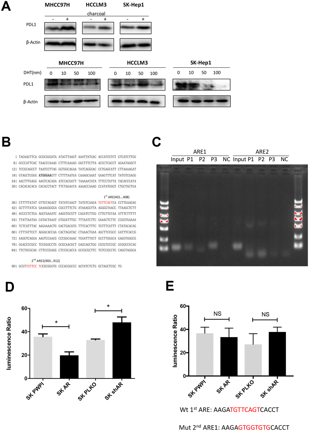 AR activates PD-L1 transcription by binding to its promoter region. (A) Castration assay was performed in three HCC cell lines. (B) Predicted localization of AREs in PD-L1 promoter region (red). (C) Chromatin immunoprecipitation was performed in wild-type SK-Hep1 cells. The detecting primer was designed based on the prediction result of potential AREs. (D) Wild-type PD-L1 promoter construct was transfected into SK-Hep1 cells with internal control pRL-TK. Then, we performed luciferase reporter assays with manipulated AR to detect if AR could affect activation of PD-L1 promoter. (E) Luciferase reporter assays were performed after transfecting mutated 1st ARE into AR-overexpressed SK-Hep1 cells and AR knocked-down SK-Hep1 cells. *PPP
