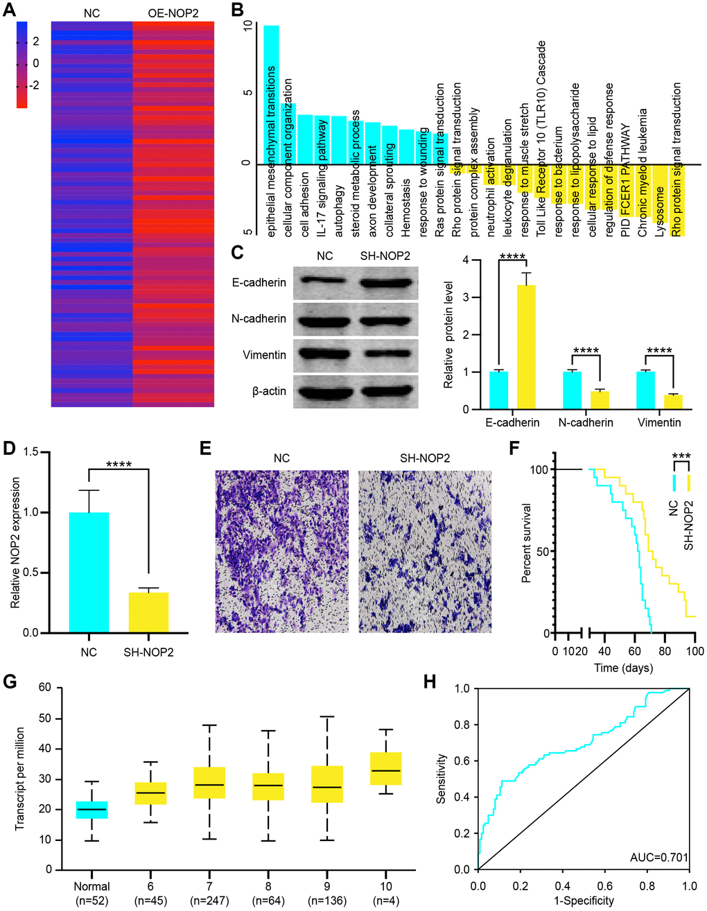 NOP2 promotes prostate cancer (PCa) cell progression through epithelial-mesenchymal transition (EMT) pathway. (A) Heat map of increased genes in DU 145 cells transfected with OE-NOP2 Lentivirus. (B) Gene enrichment analysis showed the signaling pathways activated or inhibited by NOP2 overexpression. (C) EMT related proteins (E-cadherin, N-cadherin, and vimentin) was examined by western blot in vector or OE-NOP2 Lentivirus transfected cells and the data were quantitated. (D) NOP2 expression in SH-NOP2 Lentivirus- and pcDNA-NOP2 Lentivirus–transfected DU145 cells was examined by RT-qPCR. (E) Transwell invasion assays were performed to determine the invasion of SH-NOP2 Lentivirus–or pcDNA-NOP2 Lentivirus–transfected DU 145 cells. (F) Survival time of PCa mice transfected with SH-NOP2 Lentivirus or pcDNA-NOP2 Lentivirus. (G) Transcript levels of NOP2 in normal prostate tissues and PCa tissues and differential Gleason scores. (H) Receiver operation characteristic (ROC) curve analysis of the association of NOP2 with the diagnosis of PCa (AUC = 0.701). Mean ± SEM, ***P 