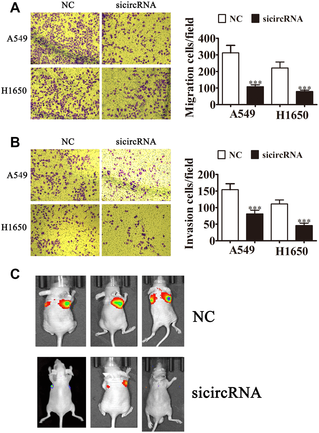 Downregulating circ-SEC31A suppressed NSCLC invasion and migration both in vitro and in vivo. (A, B) Cell migration (A) and invasion (B) were assessed in both A549 and H1650 cells using Transwell assays. Data are presented as mean ± SD; ***PC) Live imaging showing the effects of hsa