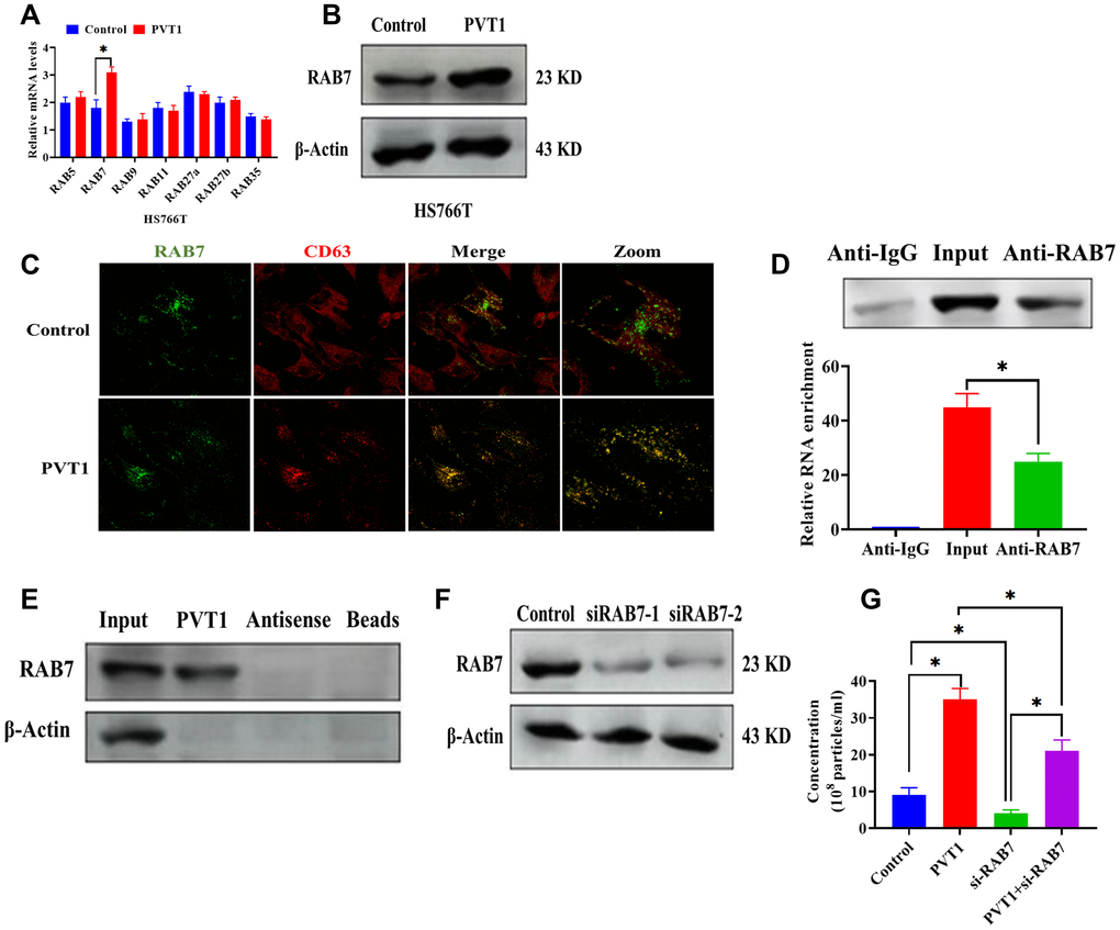 PVT1 affects the expression and localization of RAB7 in HS766T cells. (A) The mRNA expression of Rab GTPases genes in PVT1-overexpressing HS766T cells. (B) The protein expression of RAB7 in PVT1-overexpressing HS766T cells. (C) Analysis of RAB7 (green) and CD63 (red) in PVT1-overexpressing HS766T cells, as determined by confocal microscope. (D) The interaction between PVT1 and RAB7, as determined by RIP assay and qRT-PCR. (E) The correlation between PVT1 and RAB7, as determined by pull-down assay. (F) The knockdown efficiency of si-RAB7 in HS766T cells. (G) The concentration of exosome derived from HS766T cells with overexpression of PVT1 and knockdown of RAB7. *P 