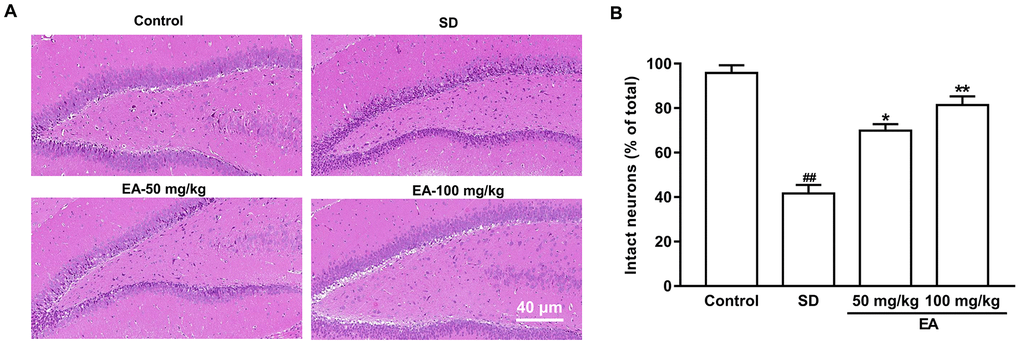 EA improved neuronal survival after SD. (A) The hippocampus was stained by hematoxylin and eosin. (B) The percentage of intact neurons relative to the total neurons for each group (six different fields were counted per slice). Scale bar=40 μm. Data values were expressed as the mean ± SEM (n=3), #P ##P *P **P 