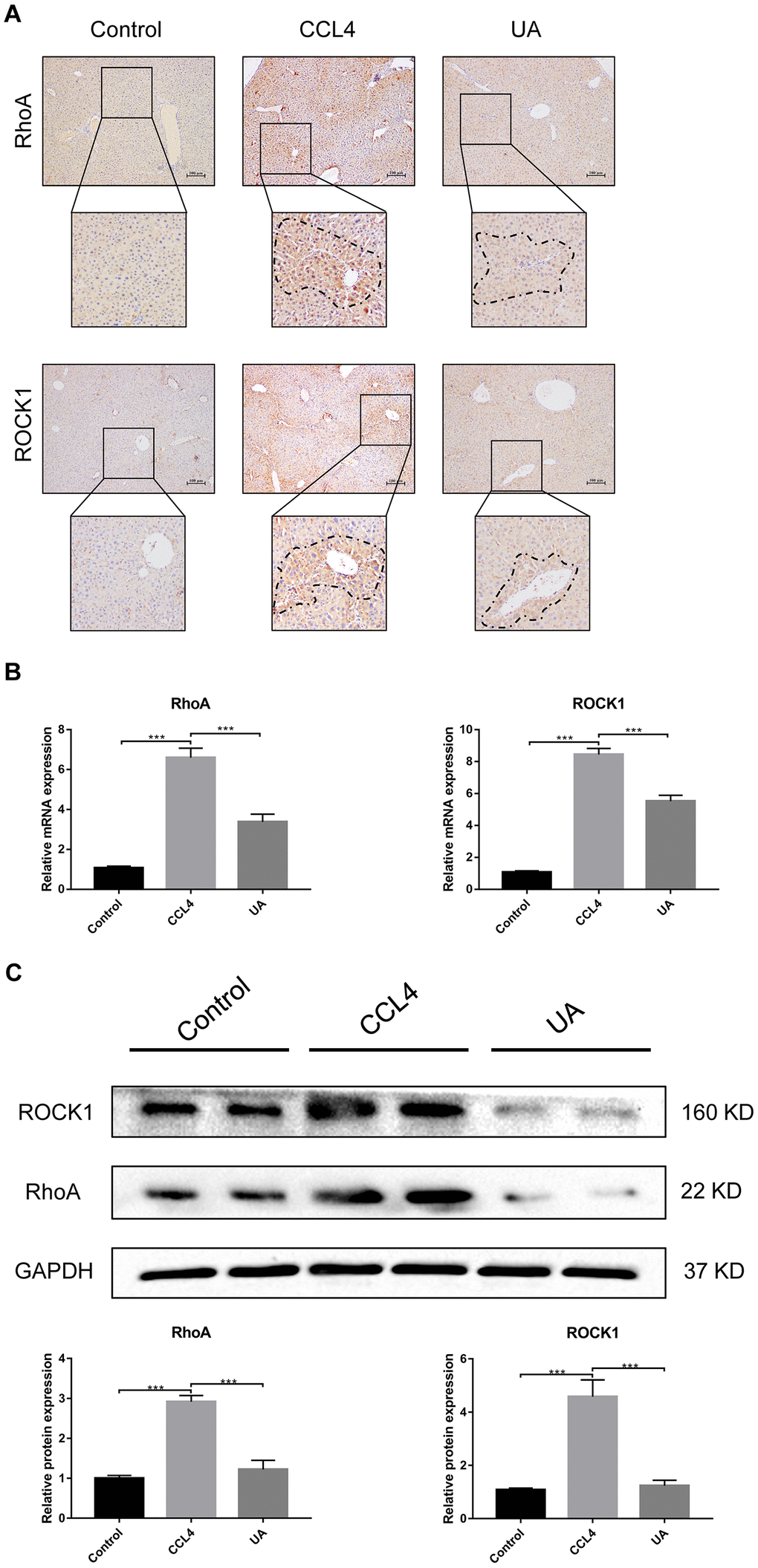 Effect of UA on the expression of RhoA/ROCK1 in liver fibrotic mice. (A) The effect of UA on RhoA/ROCK1 expression was determined by using IHC. (B) Hepatic mRNA levels of RhoA/ROCK1 were measured by qRT-PCR. (C) Hepatic protein levels of RhoA/ ROCK1 were detected by a western blot. Data represent the mean ± SD of each group. *P 
