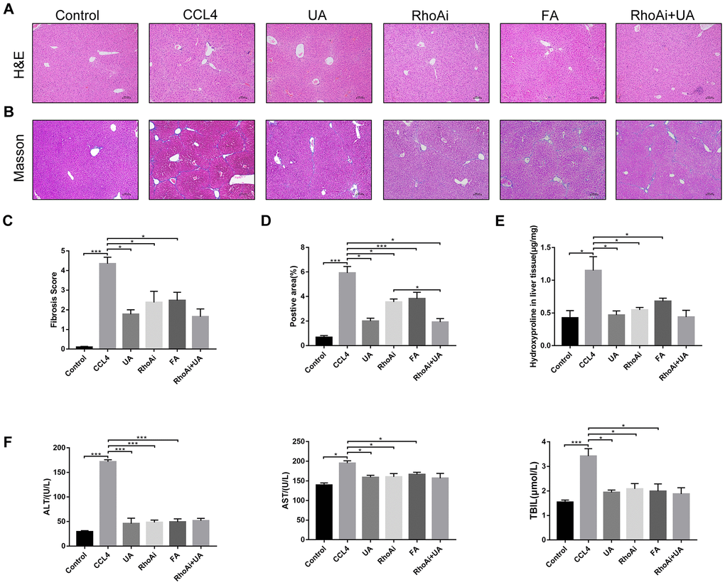 The effect of UA on CCl4-induced liver injury and fibrosis is related to RhoA. (A) HE staining (100× magnification). (B) Masson’s trichrome staining (100× magnification). (C–D) Morphometrical analysis of the fibrotic score and fibrotic area. (E) Detection of the hydroxyproline content in liver tissue by colorimetry. (F) Liver function indices in mouse sera. Data represent the mean ± SD of each group. *P 