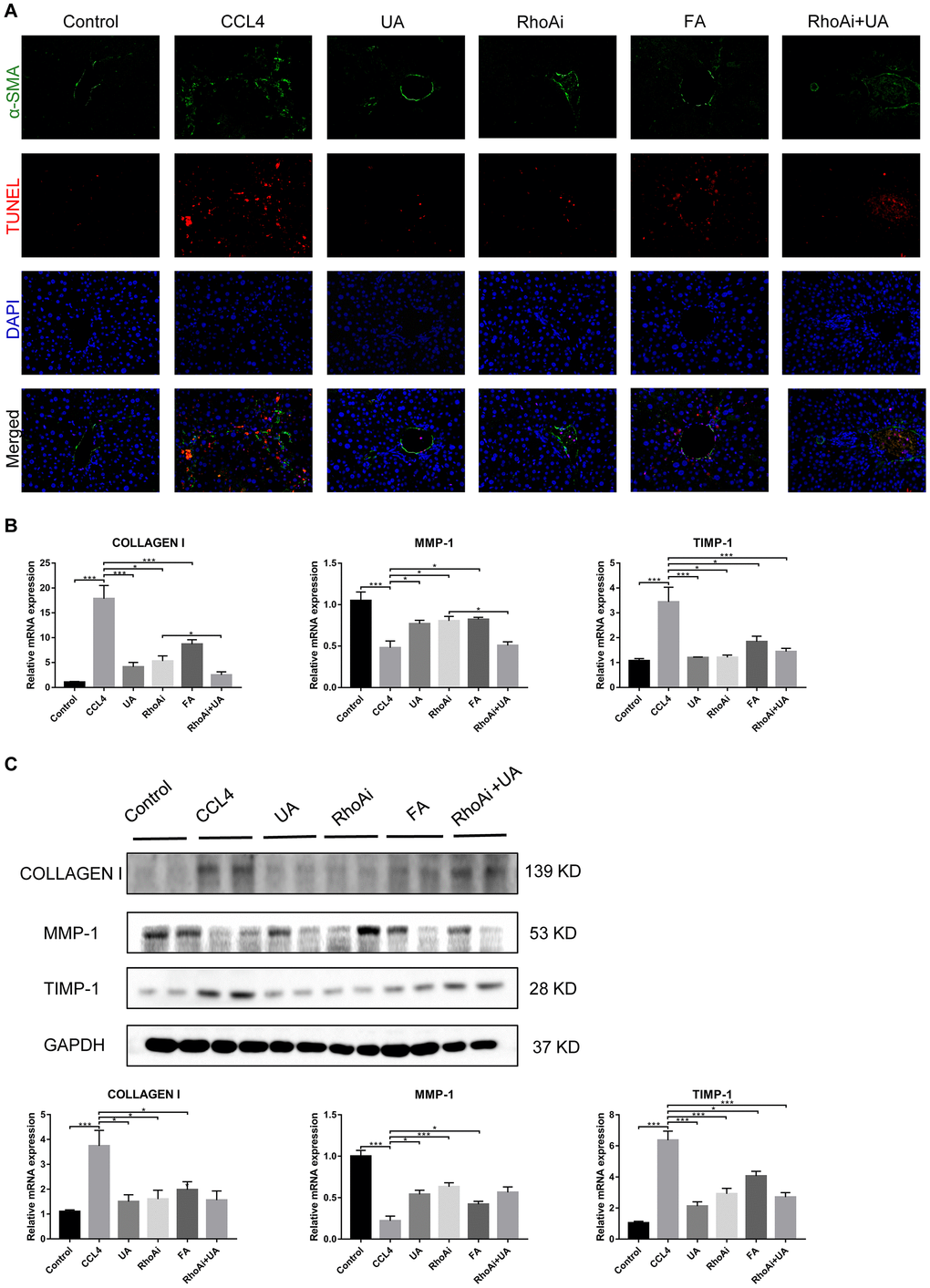 The effect of UA on CCl4-induced liver fibrosis-related indicators is related to RhoA. (A) Dual immunofluorescence staining of liver sections from mice in the control, CCl4, and UA groups stained for nuclei (DAPI, blue), aHSCs (α-SMA, green), and apoptosis (TUNEL, red), and the merged images are shown. (B) Hepatic mRNA levels of collagen I, MMP-1, α-SMA, and TIMP-1 were measured by qRT-PCR. (C) Collagen I, MMP-1, and TIMP-1 protein expression was detected by a western blot. Data represent the mean ± SD of each group. *P 