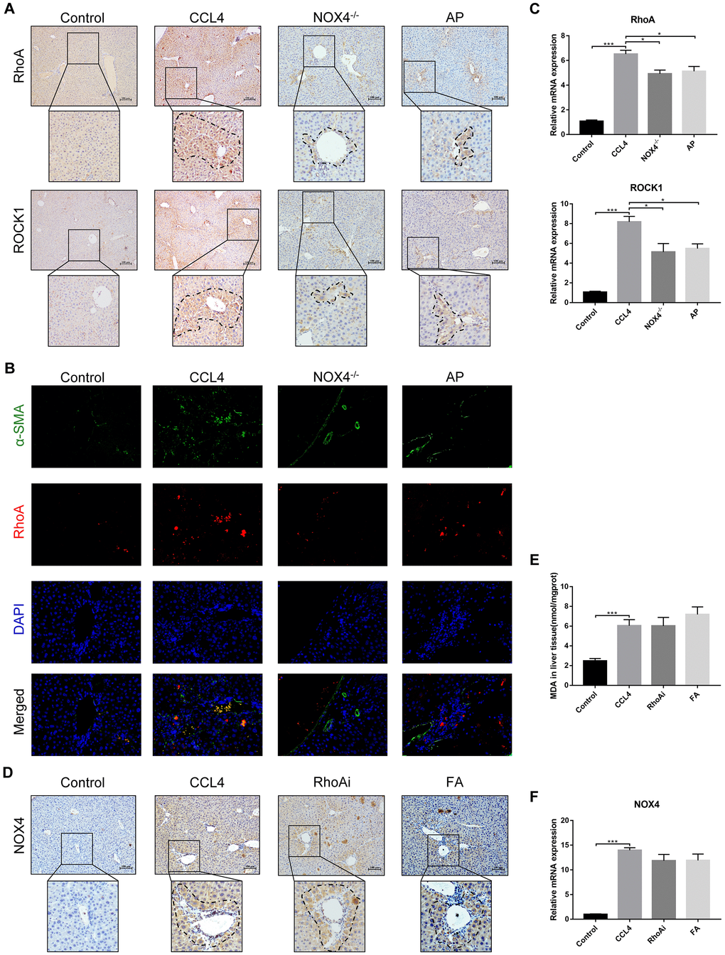 Interaction between NOX4/ROS and RhoA/ROCK1 in liver fibrotic mice. (A) In liver fibrotic mice in which NOX4 expression was inhibited, RhoA/ROCK1 expression was detected by IHC. (B) Dual immunofluorescence staining of liver sections from mice in the control, CCl4, NOX4-/- and AP groups stained for nuclei (DAPI, blue), aHSCs (α-SMA, green), and RhoA (red), and the merged images are shown. (C) Hepatic mRNA levels of RhoA/ROCK1 were measured by qRT-PCR. (D) In liver fibrotic mice in which RhoA expression was inhibited, NOX4 expression was detected by IHC. (E) Detection of the MDA content in the liver by a commercial kit. (F) Hepatic mRNA levels of NOX4 were measured by qRT-PCR. Data represent the mean ± SD of each group. *P 