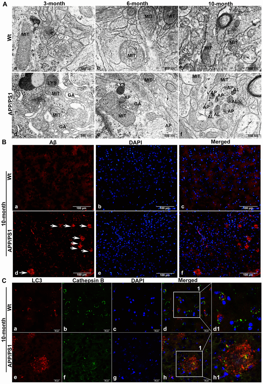 The accumulation of APs in the brain tissue of APP/PS1 DTg AD mice. (A) TEM showing little autophagy in wild-type (Wt) mice in the same litter (a-c); APs were also not easily observed in the brains of 3-month-old DTg mice (d); APs could be observed in the brains of 6-month-old DTg mice (e); a large number of APs and ALs had accumulated in the damaged axonal of brain in 10-month-old DTg mice (f). AL: autolysosome, AP: autophagosome, GA: Golgi apparatus, LYS: lysosome, MIT: mitochondria, Scale bar = 500 nm. (B) anti-Aβ 4G8 immunofluorescence staining showing no SPs in the cortex of the wild-type mice (a-c), while many SPs formed by the excessive accumulation of Aβ outside the cells in the cortex of DTg mice, (d-f, The arrow represents SP). Scale bar = 100 μm. (C) Double immunofluorescence staining showing that compared with that in Wt mice (a-d1), the expression of LC3 in 10-month-old APP/PS1 DTg mice increased significantly (e), the expression of CTSB decreased significantly (f), cell nuclei were counterstained with DAPI (g), and the co-expression of autophagosomal and lysosomal markers reduced (h). Scale bar = 20 μm, d1, h1 is a partial magnification of d and h.