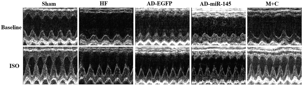Representative images of M-mode echocardiography at baseline and 5min after ISO injection, respectively.