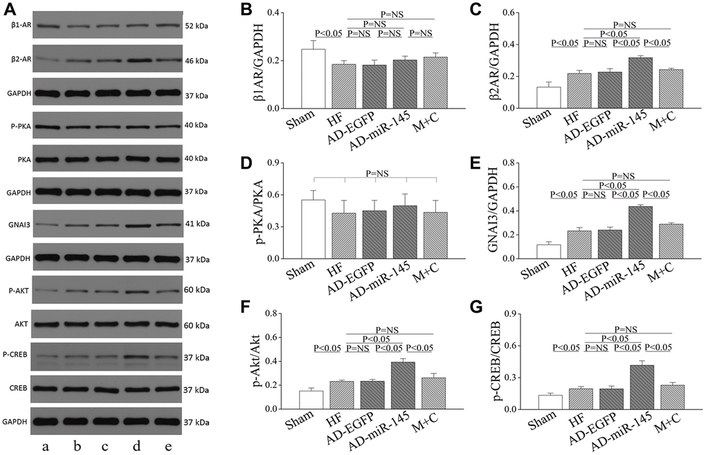 Role of miR-145 in alteration of β-adrenergic signaling. (A) Representative western blots. (B–G) quantitative analysis of the immunoreactive band displayed by bar graph (n=3). Data are presented as mean ± SD.