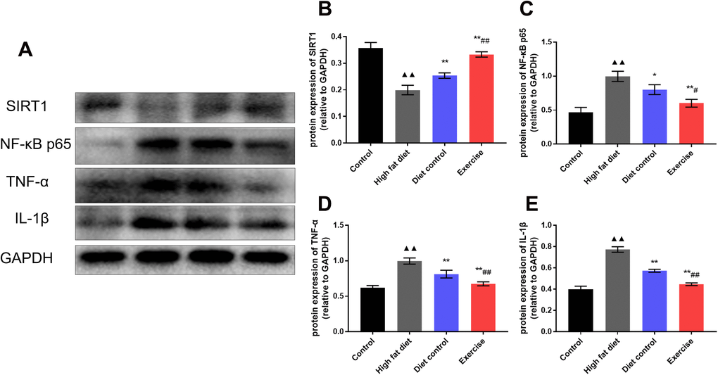 The expression of SIRT1, NF-κB, TNFα, and IL-1β proteins in the hypothalamus. (A) Western blot to detect the expression of SIRT1, NF-κB p65, TNF-α and IL-1β of the hypothalamus. (B) The expression of SIRT1 in the hypothalamus. (C) The expression of NF-κB p65 in the hypothalamus. (D) The expression of TNF-α in the hypothalamus. (E) The expression of IL-1β in the hypothalamus. vs control group, ▲▲p p p #p ##p 