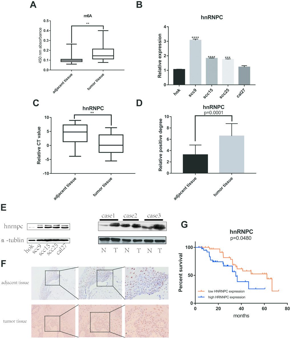 M6A and HNRNPC expression level in OSCC. (A) M6A level was detected in 80 pairs OSCC tissues and adjacent normal tissues (p=0.0047). (B, C) MRNA level of HNRNPC was detected in 4 OSCC cell lines (scc9 pD) Statistical analysis of immunohistochemistry in OSCC tissues (p=0.0001). (E) HNRNPC protein level in OSCC cell lines and tissues. (F) The represent results of immunohistochemistry. (G) Survival analysis of HNRNPC was performed in 80 OSCC samples from Nanfang Hospital (p=0.048).