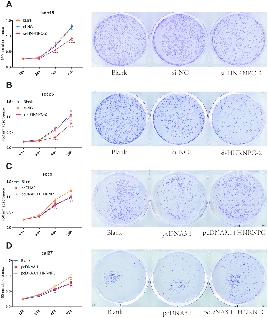 HNRNPC promoted proliferation in OSCC cell lines. (A) Si-HNRNPC inhibit cell proliferation in scc15 cell line (48h p=0.0002, 72h pB) Si-HNRNPC inhibit cell proliferation in scc25 cell line (48h p=0.0001, 72h p=0.0073). (C) Overexpression of HNRNPC promoted proliferation in scc9 cell line (48h p=0.0021, 72h p=0.0035). (D) Overexpression of HNRNPC promoted proliferation in cal27 cell line (48h p= 0.0018, 72h p= 0.0022).