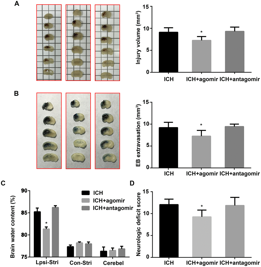 Administration of miR-183-5p reduced neurologic deficits, blood-brain barrier permeability, and brain injury volume after intracerebral hemorrhaging (ICH). (A) Left: representative images of a series of brain slices from different groups at 3 days after ICH. Right: quantitative analysis of hematoma volume. n = 8/group. (B) Left: representative images of brain slices from different groups at 3 days after ICH stained with Evans blue (EB). Right: quantitative analysis of EB extravasation. n = 8/group. (C) Brain water content in the different groups at 3 days after ICH. n = 8/group. Ipsi-Stri, ipsilateral striatum; Con-Stri, contralateral striatum; Cerebel, cerebellum. (D) Neurologic deficit scores of mice at 3 days after ICH. n = 24/group. Values are presented as the mean ± standard deviation. *P 