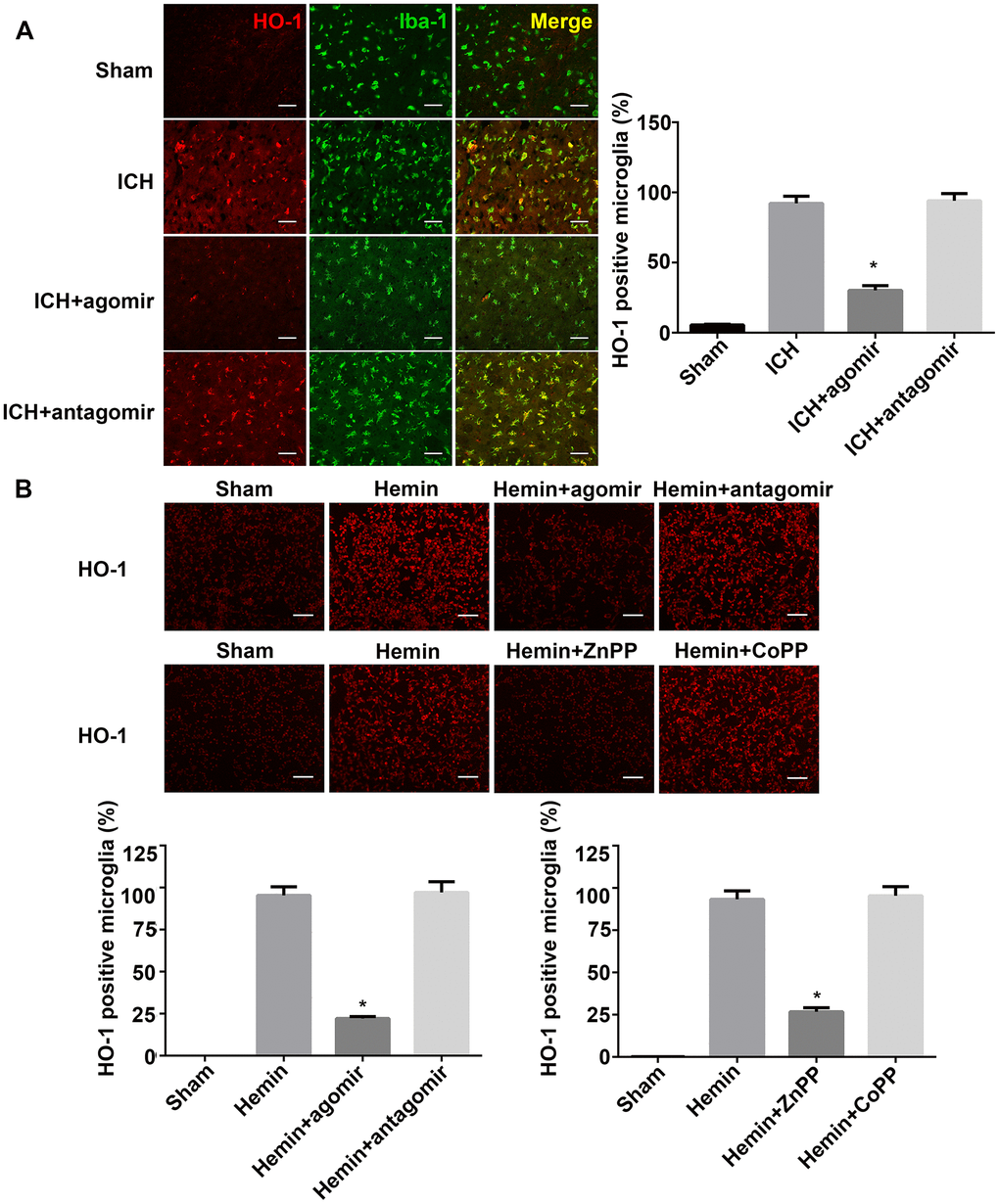 miRNA-183-5p affected microglial survival by targeting heme oxygenase-1 (HO-1) after intracerebral hemorrhage (ICH). (A) Left: representative immunofluorescence images of HO-1 in Iba-1–positive microglia at 3 days after ICH. Right: percentage of both Iba-1– and HO-1–positive cells in Iba-1–positive microglia. Scale bars = 50 μm, n = 8/group. *P B) Above: representative immunofluorescence images of HO-1 in BV2 microglia from different groups at 24 hours after hemin treatment. Below: percentage of HO-1–positive BV2 microglia. Scale bars = 50 μm, n = 3/group. *P 