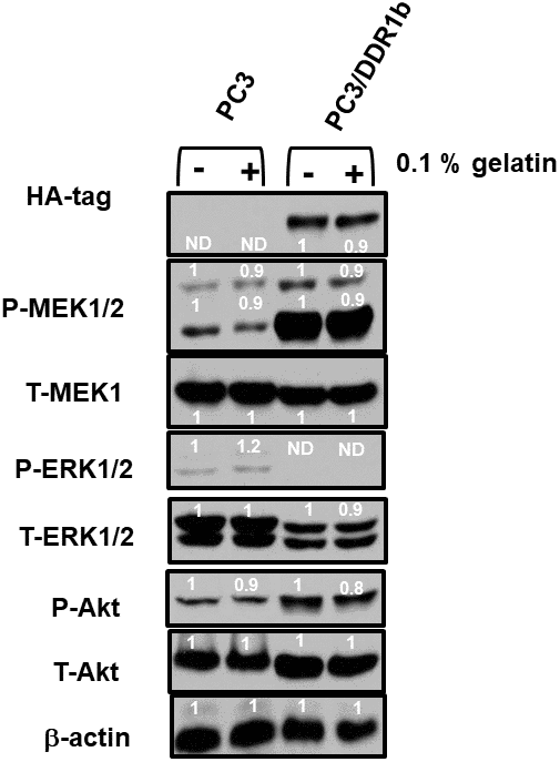 Effects of introduction of DDR1b on Raf/MEK/ERK and Akt protein levels in PC3 Prostate cancer cells. Western blot analysis was performed to determine the levels DDR1 and key members of the RAF/MEK/ERK pathway and Akt in response to introduction of DDR1b. Cells were cultured in the presence and absence of 0.1 gelatin which in some circumstances activates DDR1. The levels of DDR1b were determined upon analysis with an HA-tag antibody as the DDR1b encoding retrovirus has a HA-tag. Levels of β-actin were determined as a protein loading control These experiments were repeated twice, and similar results were observed. The fold values shown in white numbers and letters are presented as averages of 3 densitometric readings. ND = not detected.