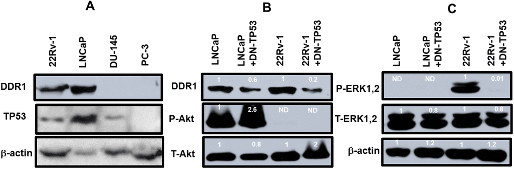 DDR1 and TP53 expression in four prostate cancer cell lines. Panel (A) The levels of DDR1, TP53 and β-actin expression were determined in 22Rv-1, LNCaP, DU145 and PC3 cells. Panel (B) The levels of DDR1, P-Akt and T-Akt were determined in LNCaP, LNCaP + DN-TP53, 22Rv-1 and 22Rv-1 + DN-TP53 cells. Panel (C) The levels of P-ERK1,2 were determined in LNCaP, LNCaP + DN-TP53, 22Rv-1 and 22Rv-1 + DN-TP53 cells. The fold values shown in white numbers and letters are presented as averages of 3 densitometric readings. Only similar cell lines are compared. ND = none detected.