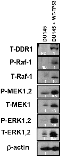 Effects of restoration of WT-TP53 on DDR1 and Raf/MEK/ERK protein levels in DU145 prostate cancer cells either lacking or containing functional WT-TP53. Western blot analysis was performed to determine the levels DDR1 and key members of the Raf/MEK/ERK pathway in response to restoration of WT-TP53. Levels of actin were determined as a protein loading control These experiments were repeated twice, and similar results were observed. The fold values shown in white numbers and letters are presented as averages of 3 densitometric readings. ND = not detected.