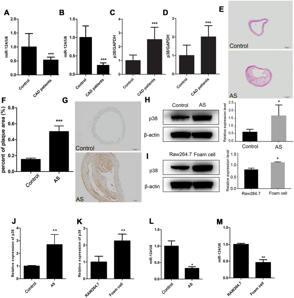 Expression of miR-124 and p38 in coronary artery disease (CAD). (A) Comparison of miR-124 expression in blood plasma between patients without CAD (n=40) and patients with CAD (n=40). (B) Comparison of miR-124 expression in peripheral blood mononuclear cells between patients without CAD (n=40) and patients with CAD (n=40). (C) Comparison of p38 expression in blood plasma between patients without CAD (n=40) and patients with CAD (n=40). (D) Comparison of p38 expression in peripheral blood mononuclear cells between patients without CAD (n=40) and patients with CAD (n=40). (E) Hematoxylin and eosin staining of aorta specimens from atherosclerosis mice and control mice. Bar = 200 μm. (F) Quantitative analysis of the percentage of plaque area in control mice and atherosclerosis model mice. (G) Immunohistochemistry analysis of p38 protein level in aorta of atherosclerosis mice and control mice. Bar = 100 μm. (H) Western blot analysis of p38 protein level in aorta of atherosclerosis mice and control mice. (I) Western blot analysis of p38 protein level in RAW264.7 cells and foam cells. The foam cells were induced by treating with oxidized low-density lipoprotein (ox-LDL) for 48 h. (J) qRT-PCR analysis of p38 mRNA expression in atherosclerosis mice and the control mice. (K) qRT-PCR analysis of p38 expression in RAW264.7 cells and foam cells. (L) Stem-loop qRT-PCR analysis of miR-124 expression in atherosclerosis mice and the control mice. (M) Stem-loop qRT-PCR analysis of miR-124 expression in RAW264.7 cells and foam cells. β-actin was used as an internal reference in Western blot. GAPDH was used as an internal reference in qRT-PCR assay. U6 was used as an internal reference in stem-loop qRT-PCR. *, P P P 