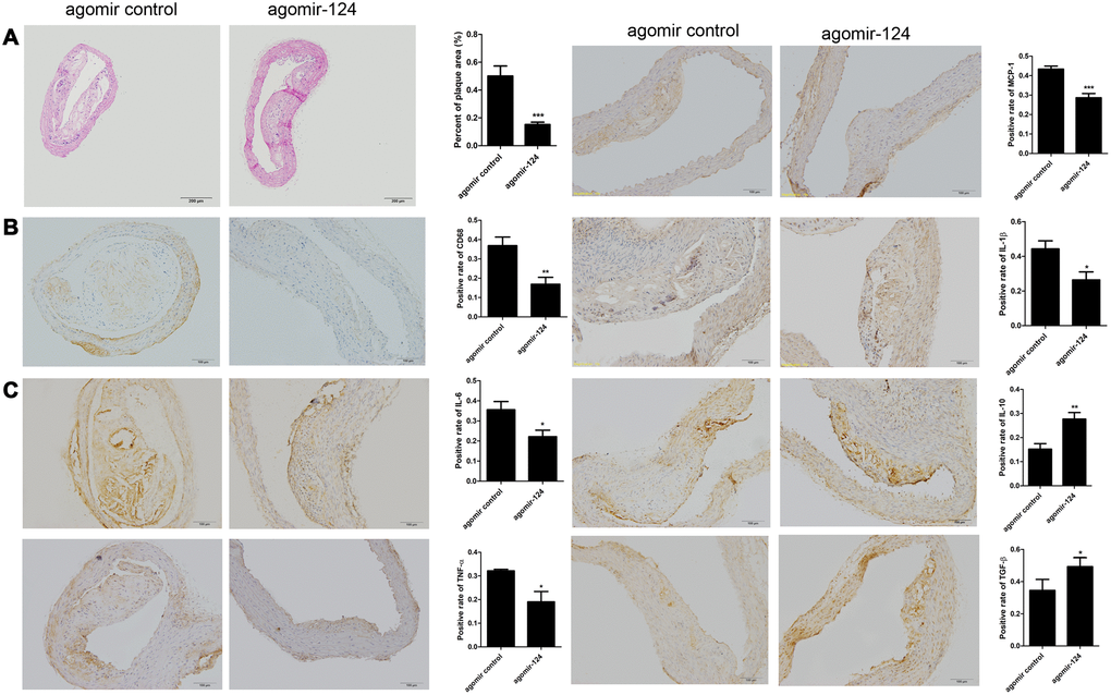 MiR-124 agomir inhibited CD68, pro-inflammatory cytokines and promoted anti-inflammatory cytokines in the thoracic aorta of atherosclerosis model mice. (A) Hematoxylin and eosin staining of thoracic aorta specimens from atherosclerosis model mice treated with agomir control or agomir-124. Bar = 200 μm. (B) Immunohistochemistry analysis of the protein levels of CD68. Bar = 100 μm. (C) Immunohistochemistry analysis of the pro-inflammatory cytokines and anti-inflammatory cytokines in the thoracic aorta of atherosclerosis model mice treated with agomir control or agomir-124. Bar = 100 μm. *, P P P 