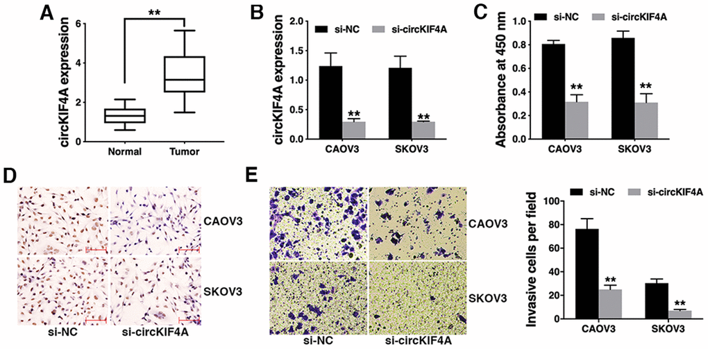 Knockdown of circKIF4A inhibits ovarian cancer proliferation and invasion in vitro. (A) The expression of circKIF4A in ovarian cancer tissues (Tumor) and normal adjacent tissues (Normal). (B) circKIF4A was successfully knocked down by siRNA. (C) CCK-8 assay was performed to detect cell proliferation. (D) BrDU immunostaining of ovarian cancer cells transfected with si-NC of si-circKIF4A. (E) Transwell assay was performed to assess cell invasive ability (left) and the number of invasive cells was quantified by ImageJ (right). **P 