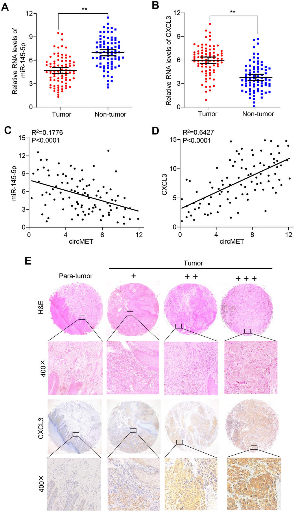 CXCL3 exerts oncogenic effects in NSCLC tissues. (A) and (B) miR-145-5p and CXCL3 expression were detected in 94 paired NSCLC tissues and adjacent normal tissues using qRT-PCR. GAPDH was used as a control for loading. (C) A negative correlation between miR-145-5p and circMET was observed in NSCLC tissues. (D) A positive correlation between circMET and CXCL3 was observed in NSCLC tissues. (E) Representative images of TMA stained with H&E and IHC for CXCL3 expression in NSCLC tissues and adjacent nontumor tissues (−, absent; +, weak; ++, moderate; and +++, strong). Scale bar: 100um. The data are represented as the mean ± SD, * p 