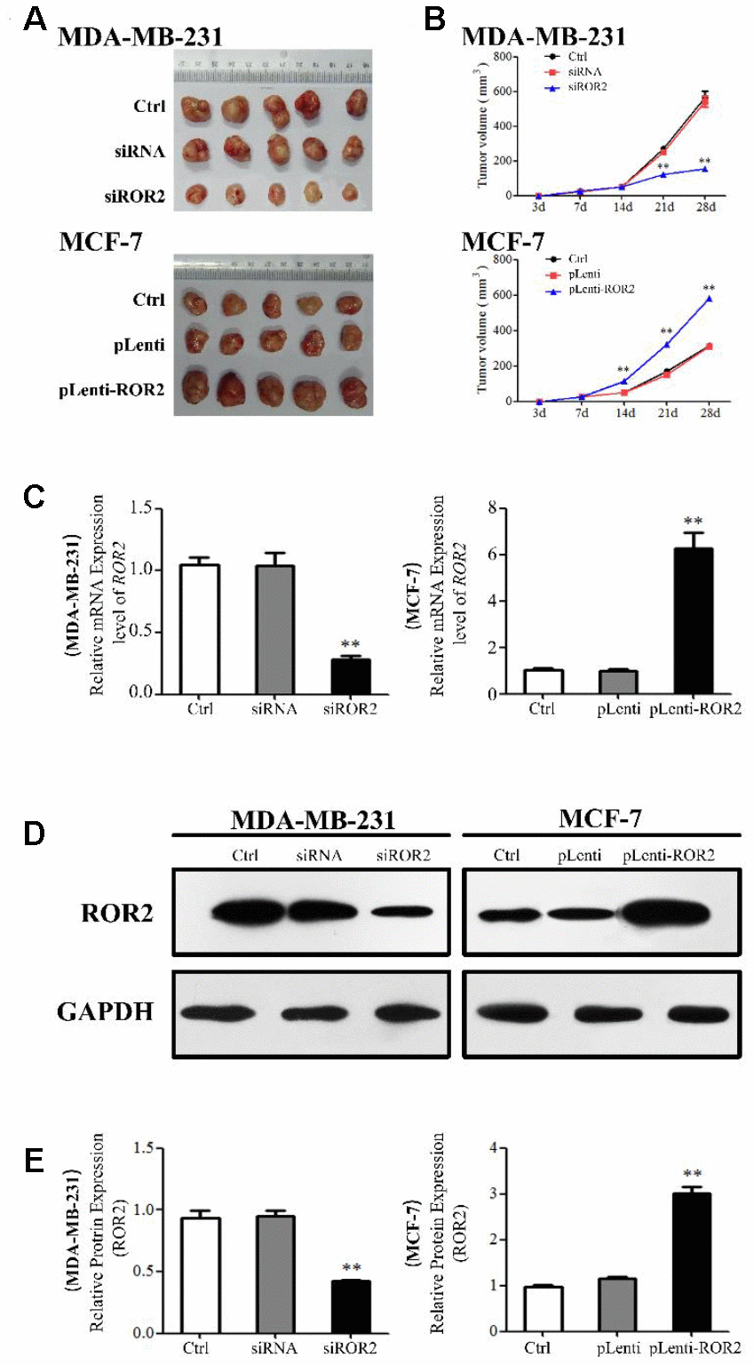 ROR2 promotes BC tumorigenesis in vivo. (A, B) Tumor growth in mice implanted with BC xenografts with suppressed (A) and overexpressed (B) ROR2. (C) qRT-PCR of ROR2 in ectopic tumors. (D, E) Western blotting of ROR2 protein expression in ectopic tumors. *pn=6.